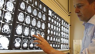 Gesellschaft für Epilepsieforschung e.V. - Forschung zu Ursachen und Therapien von Epilepsie
