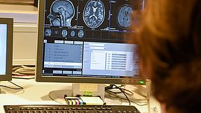 Mitarbeiterin schaut sich auf dem Monitor Aufnahmen von einem Gehirn an.